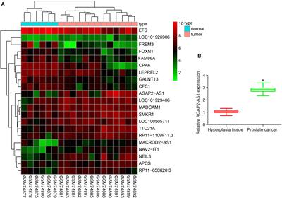 Long Non-coding RNA AGAP2-AS1 Silencing Inhibits PDLIM5 Expression Impeding Prostate Cancer Progression via Up-Regulation of MicroRNA-195-5p